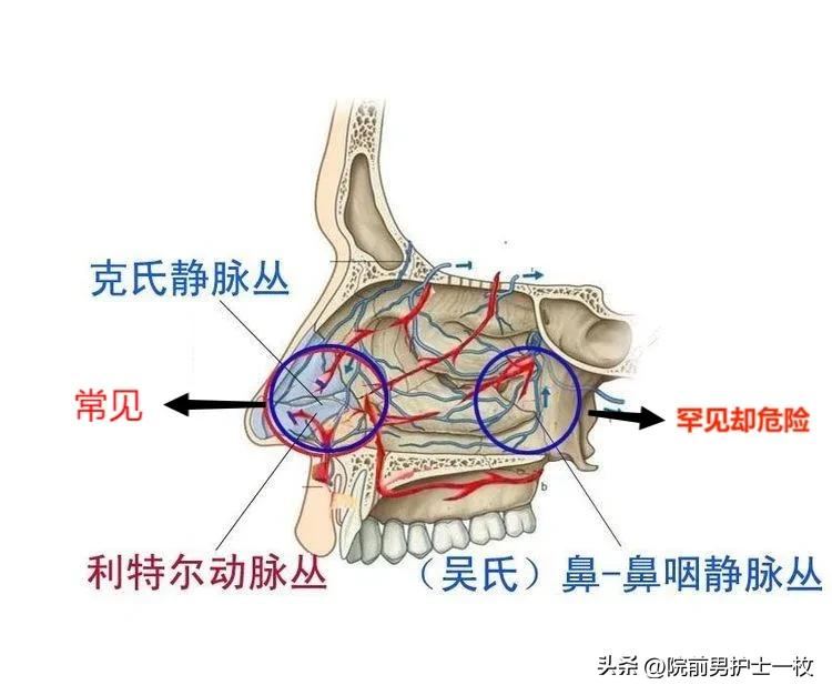 运动后鼻血止不住_运动后流鼻血_运动鼻血
