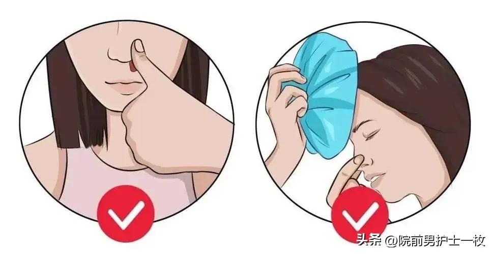 运动鼻血_运动后鼻血止不住_运动后流鼻血
